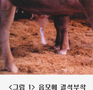 그림 1. 음모에 결석부착
